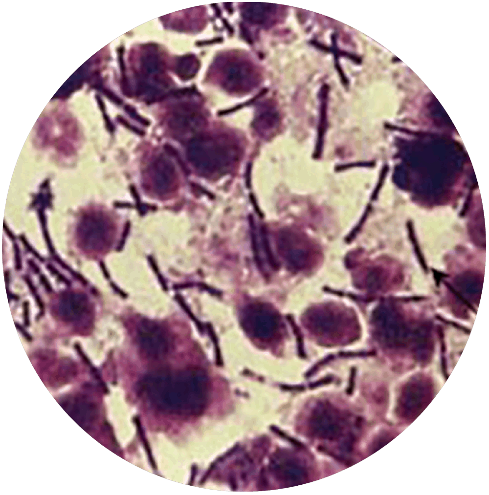 Bacillus Globigii